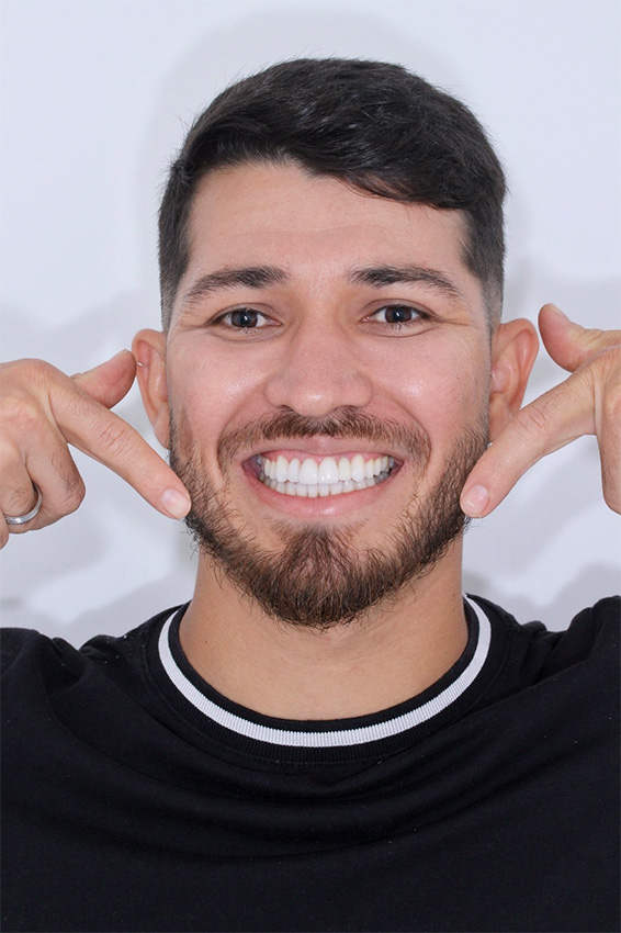Implante dentário