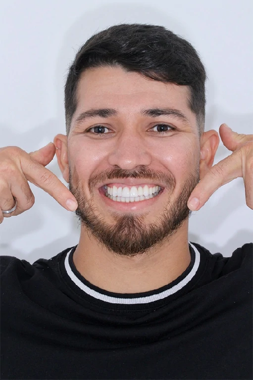 Implante dentário