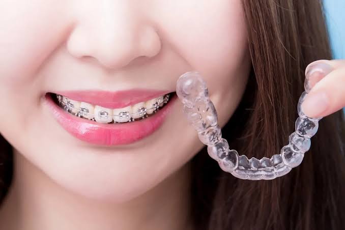Implante dentário